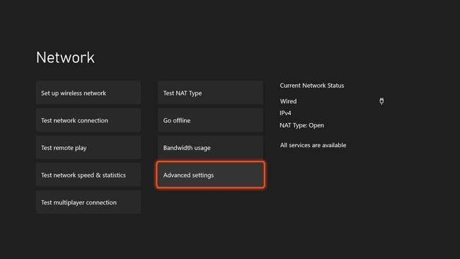 Verkkoasetukset Xbox Series X|S:ssä.