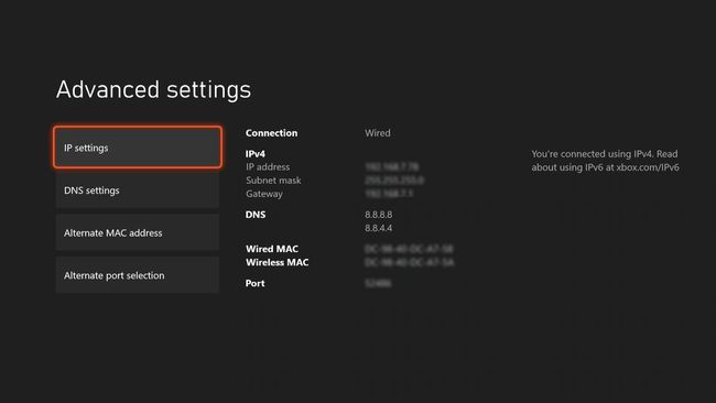 Verkkoasetukset Xbox Series X|S:ssä.