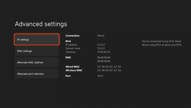Xbox Series X|S:n IP-asetukset.