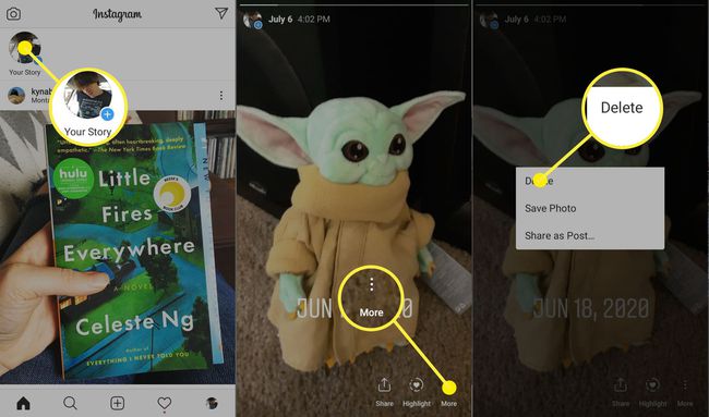Noudatettavat vaiheet Instagram-tarinan poistamiseksi.