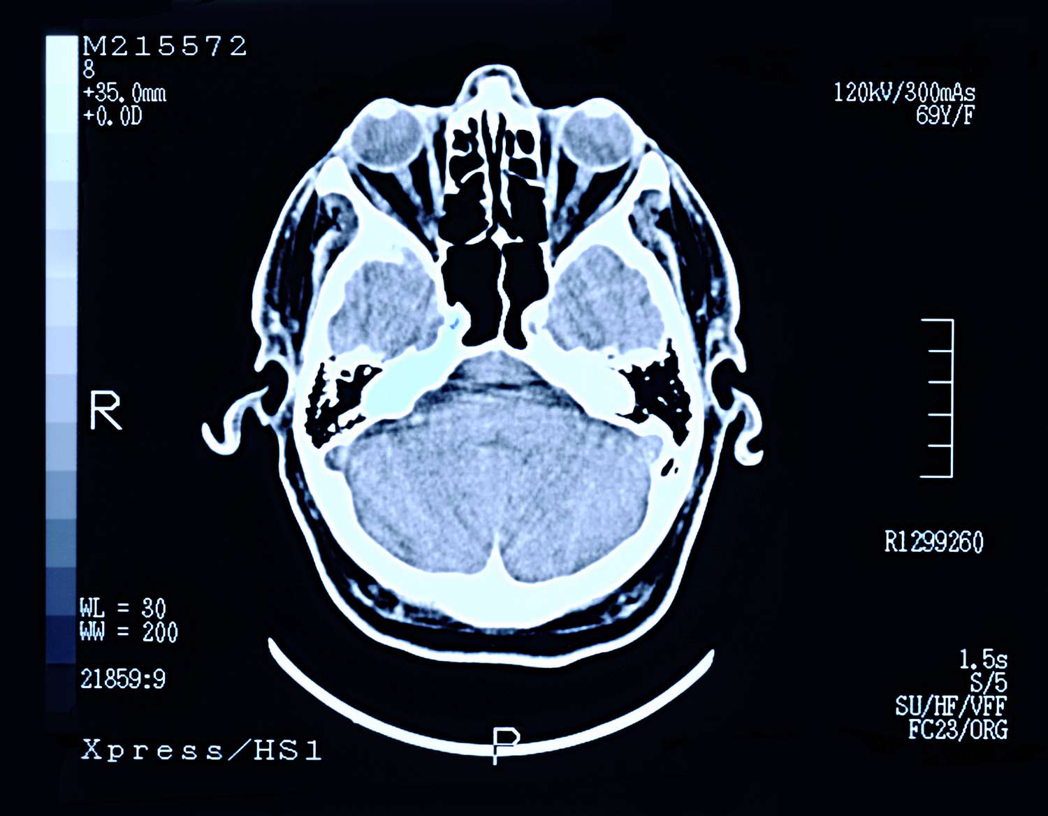 brain scan peter dazeley photographers choice getty images 56e09ed65f9b5854a9f855fc